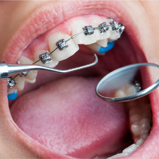 Dental Treatment