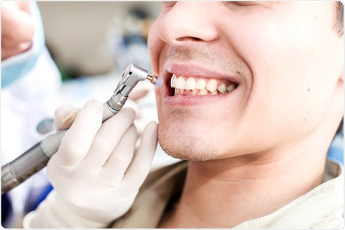 Tooth Polishing Polishing