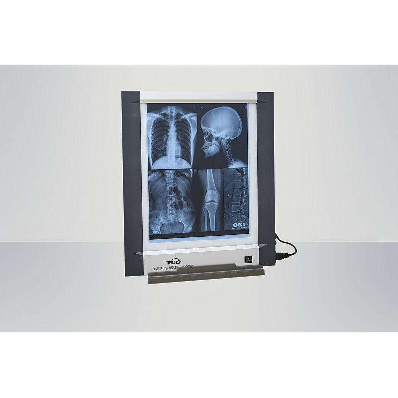 x-ray viewbox